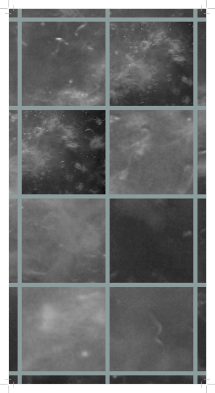 Worm grid 5