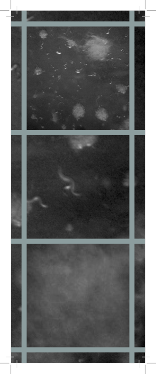 Worm grid 6